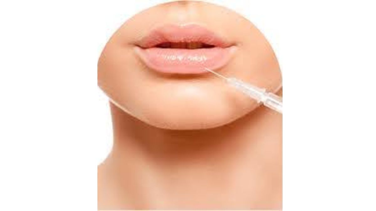 Dermal Fillers